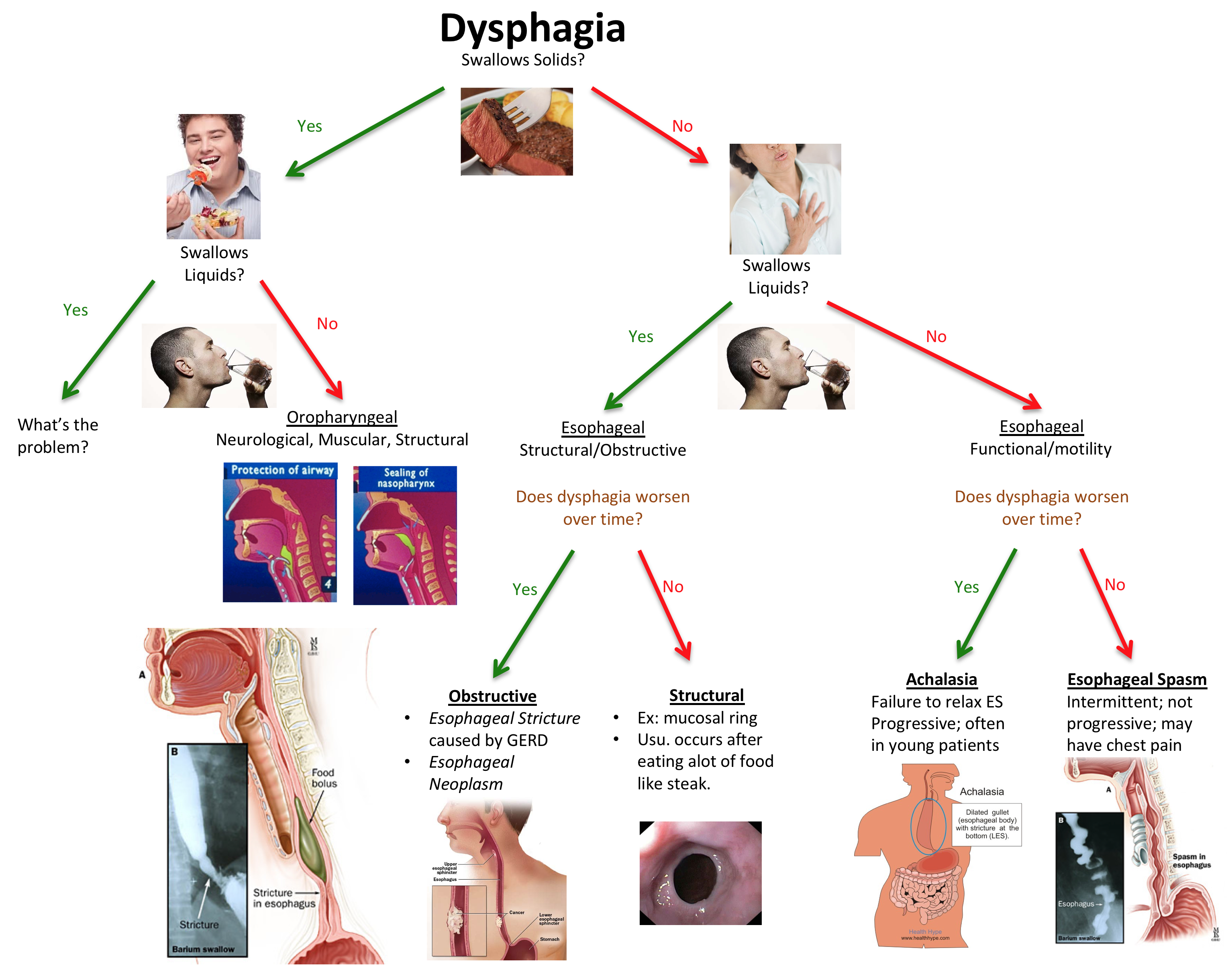 Approach To Dysphagia CodeHealth