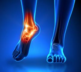 Ankle Pain