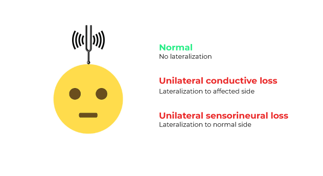 Sensorineural Vs Conductive Hearing Loss Codehealth