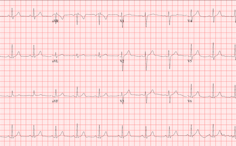 case-sudden-onset-chest-pain-and-difficulty-breathing-codehealth