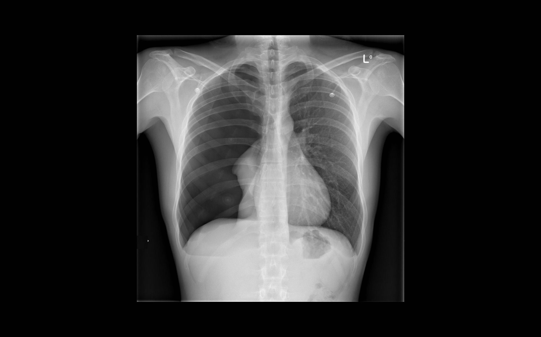 Case Sudden Onset Chest Pain And Difficulty Breathing CodeHealth